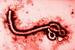 ebola microscopio virus globalresearch.ca
