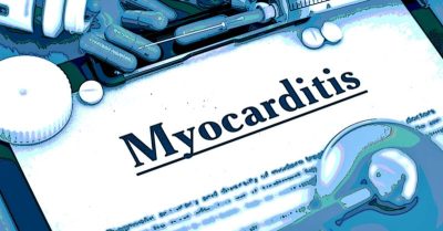 myocarditis-400x209.jpg